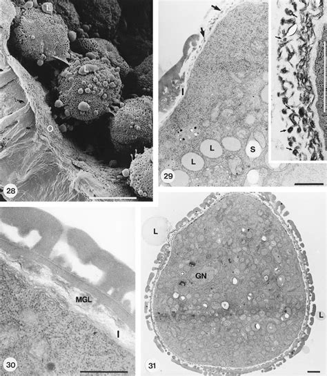 Mature Pollen Grains At Dehiscence 28 Pollen Grains In Locule Covered