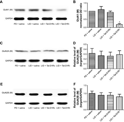 Effects Of Intrastriatal Administration Of Tat D1ri On Membrane NMDa