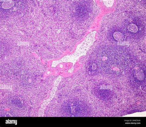 Human Spleen Light Micrograph Stock Photo Alamy