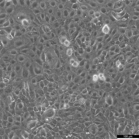 SCC 25 Cells