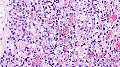 Parathyroid Histology Labeled