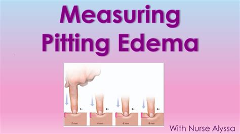 Pitting Edema Scale