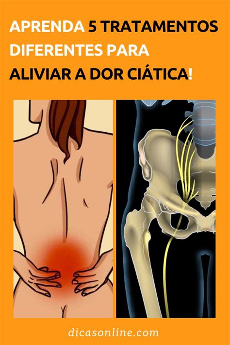 Aprenda 10 tratamentos diferentes para aliviar as dores ciáticas Dor