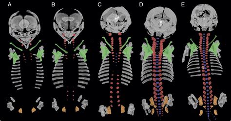 Skeletal Development In Sloths And The Evolution Of Mammalian Vertebral Patterning Pnas