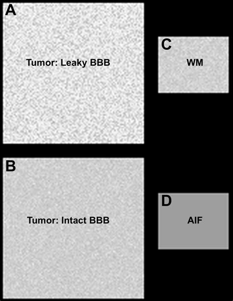 GBM DSC MRI DRO The Cancer Imaging Archive TCIA