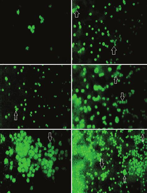 Acridine Orange Ethidium Bromide Staining Of Different Concentrations