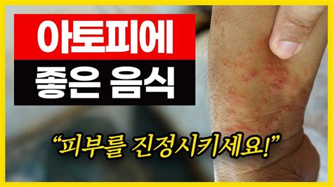 아토피 피부에 좋은 음식 피부를 진정시키는 이 음식을 꼭 드세요 Youtube