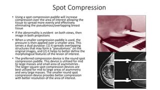 Mammography Positioning Technique for Additional Views | PPT