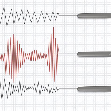 Lie Detector Test Chart