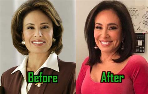 Jeanine Pirro Plastic Surgery: Botox, Facelift, Cheek Fillers, Lip Fillers