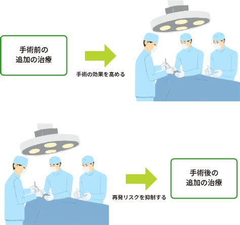 肺がんの周術期治療（手術に追加して行う治療）について｜おしえて 肺がんのコト【中外製薬】