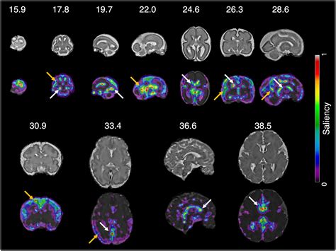 Frontiers Optimal Method For Fetal Brain Age Prediction Using