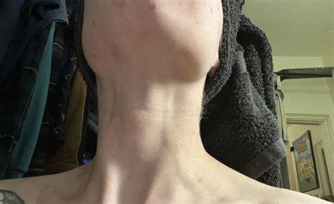 Something wrong with neck : r/medical