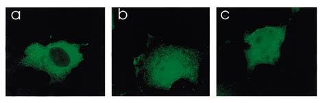 Effect Of Lmb On The Subcellular Localization Of Fmrpi304n Cos Cells