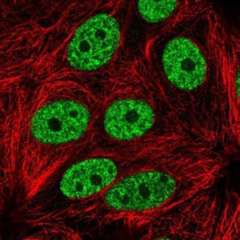 YLPM1 Polyclonal Antibody Invitrogen 100 μL Unconjugated Fisher