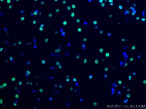 TDP 43 Monoclonal Antibody 1G5F6 CoraLite488 Proteintech 100 μL