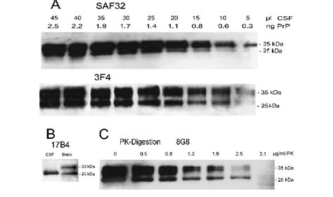 Western Blot Detection And Appearance Of Prp C In Serially Diluted Csf