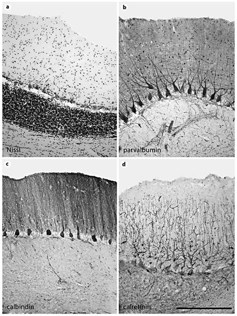 Low Power Photomicrographs Of Stained Sections Through The African