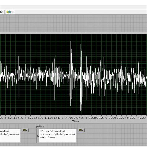 15-second phonocardiogram of a 20-year-old woman with 32 weeks of ...