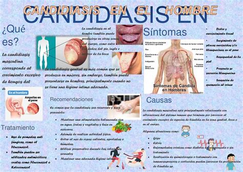 Candidiasis Hombres Alba Daniela Arancibia Delgado Udocz