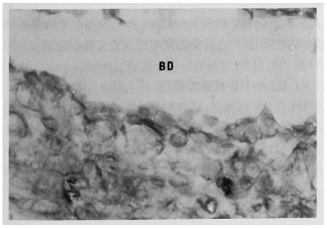 Figure 1 From The Role Of Dendritic Cells In Bile Duct Destruction Of Primary Biliary Cirrhosis