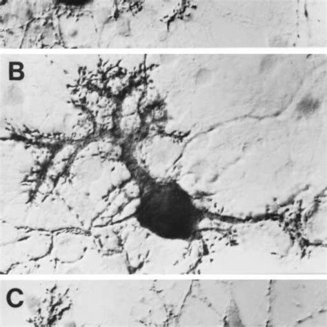 Other Neurotrophins And Purkinje Cell Spine Density Purified Purkinje Download Scientific