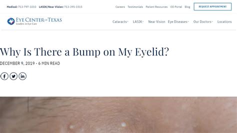 Bumps On My Eyelid Beauty Tips