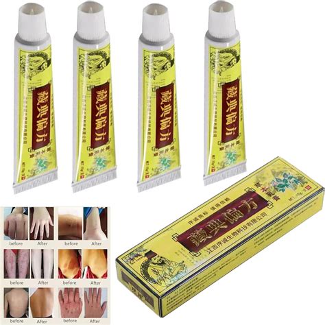 Buy Pcs Natural Chinese Herbal Eczema Psoriasis Cream Dermatitis