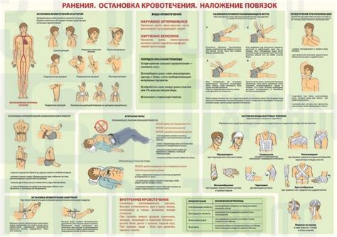 Купить плакаты по оказанию первой помощи