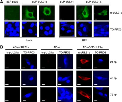 Pul21a Predominantly Localizes To The Cytoplasm Of Both Overexpressing