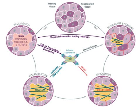 Get Your Guide On The Inflammatory And Immune Processes Of Fibrosis