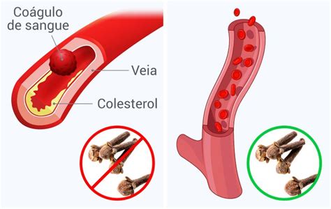 O Que Acontece O Seu Corpo Se Voc Comer Dois Cravos Por Dia Incr Vel