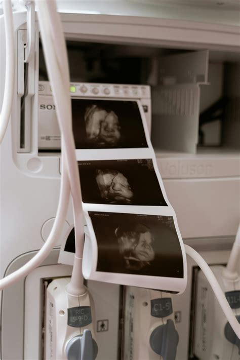 Ultrasound Scan Photos, Download The BEST Free Ultrasound Scan Stock ...