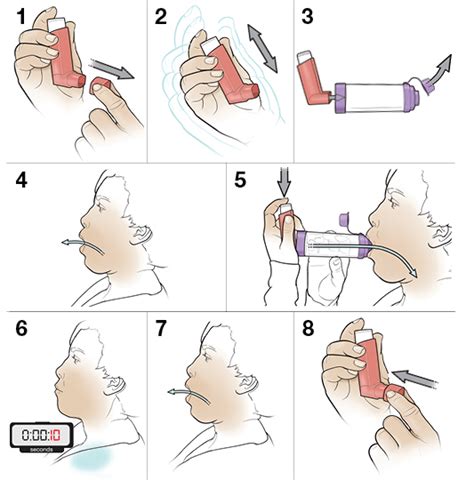 Step By Step Using An Inhaler With A Spacer Yourcareeverywhere