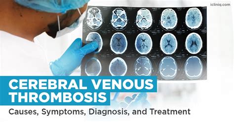 What Is Cerebral Venous Thrombosis?