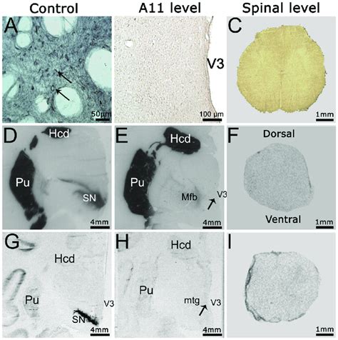 Absence Of Dopamine Transporter Expression In The Diencephalospinal