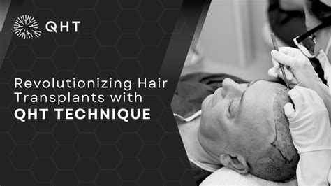 Leading Hair Transplant Clinic In India Offering Advanced Qht Technique Oneindia News