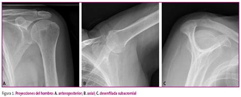 FAPap El Estudio Radiologico De La Patologia Osteoarticular Generalidades