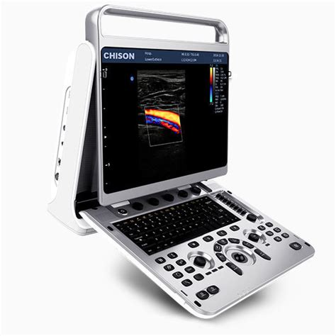 Aparelho de ultrassom portátil EBit 20 CHISON Medical Technologies