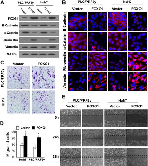 Overexpression Of Foxg1 Promotes Cell Mobility And Invasion By Inducing