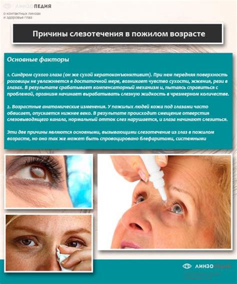 Почему слезятся глаза на улице, что делать. Почему слезятся глаза у ...