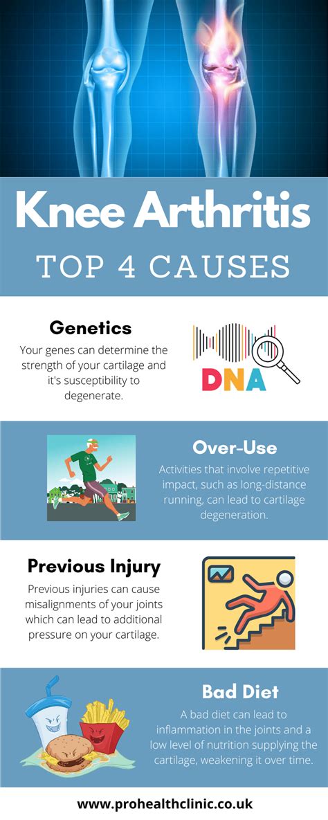 Top 4 Causes of knee arthritis - ProHealth Prolotherapy Clinic