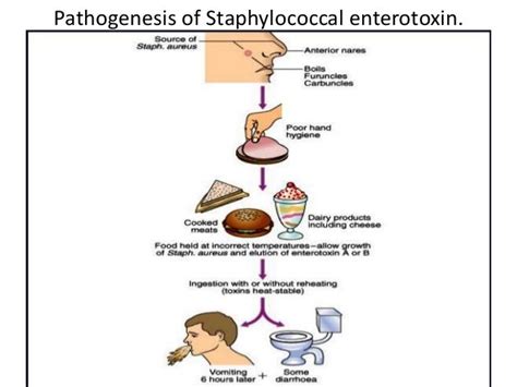 Food poisoning- Microbiology