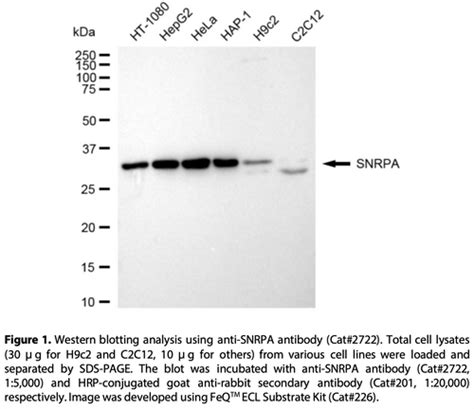 Anti SNRPA Rabbit Monoclonal Ab 2722 GenuIN Biotech