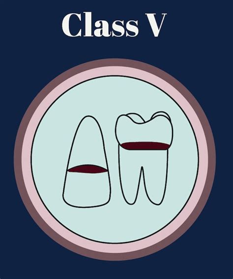 Tooth Numbering System Diagram Svg Png Jpeg Ai Pdf Dental Dentistry Jaw Dent Dentalschool ...