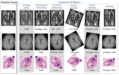 Examples of augmentations applied to sample images. The | Download ...