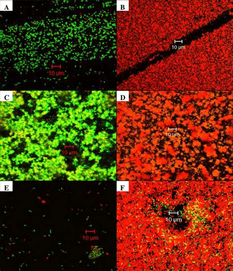 Confocal Microscopy Of Biofilms After 24 Hours Of No Exposure Left Or