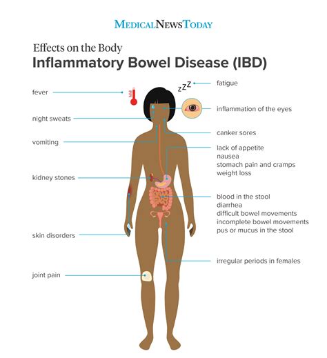 Infectious Colitis Disease