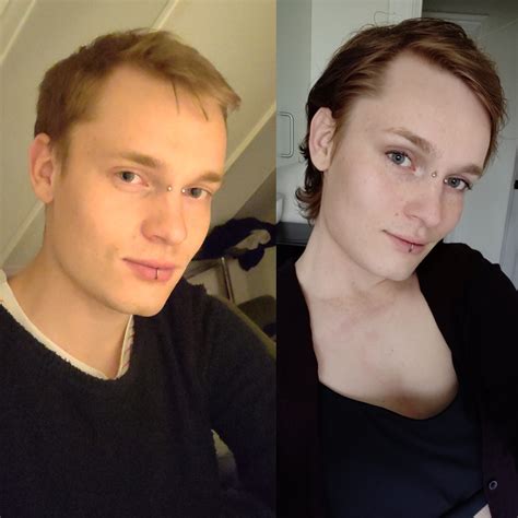 Subtle Changes After 8 Months On Hrt 25yo Rtranstimelines