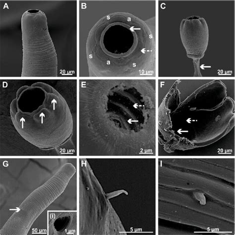 Phylogram Of Camallanidae Based On Co Mtdna With Spirocerca Lupi